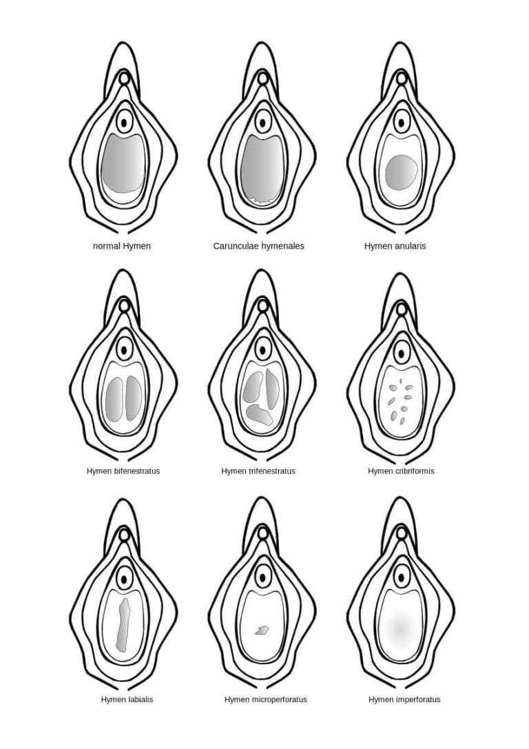 Minimizing Pain During First and Early Intercourse